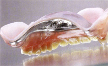 images_denture08